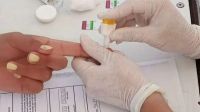 Sífilis: cómo prevenirla y la importancia de su detección