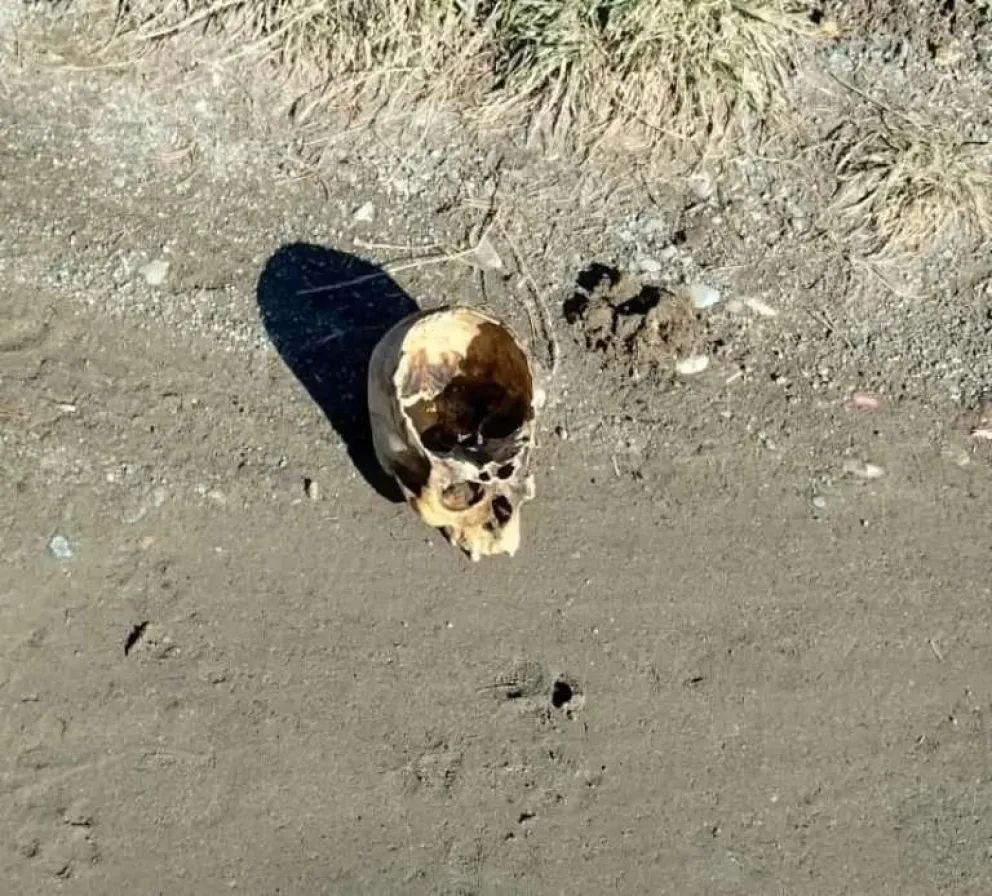 Investigan el origen del cráneo humano encontrado por un taxista en calle La Paz